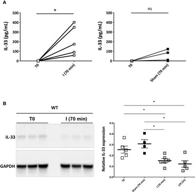 Endogenous Interleukin-33 Acts as an Alarmin in Liver Ischemia-Reperfusion and Is Associated With Injury After Human Liver Transplantation